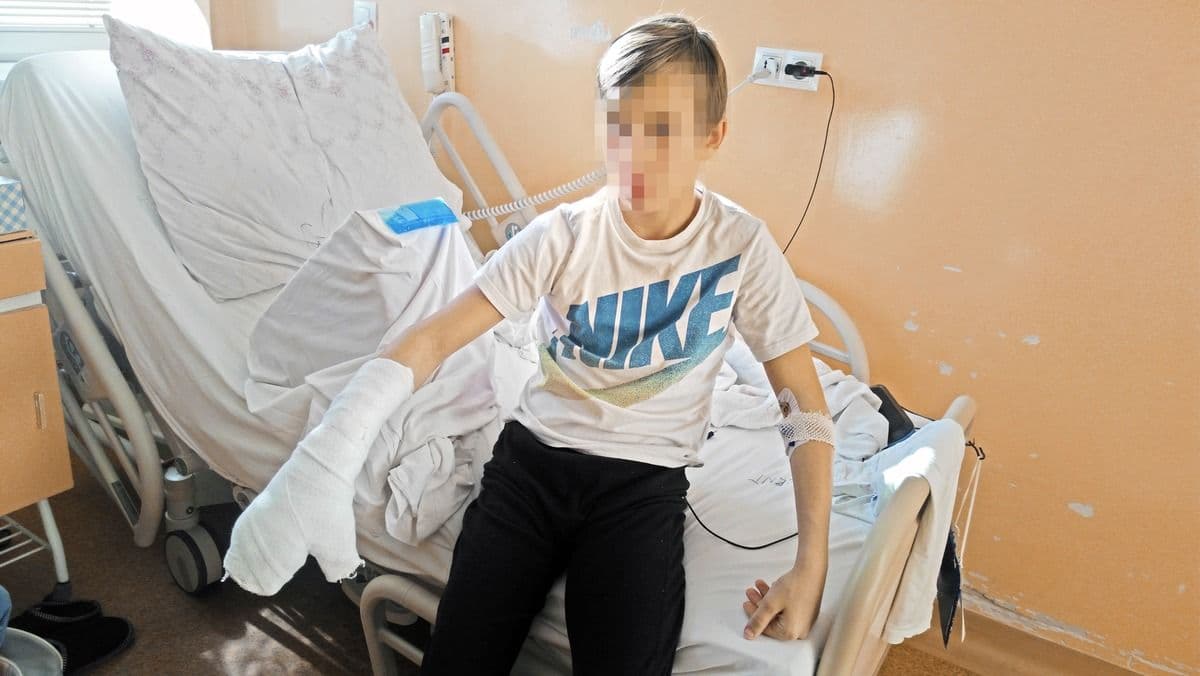 Kis híján letépte a 12 éves fiú kezét a felrobbanó petárda