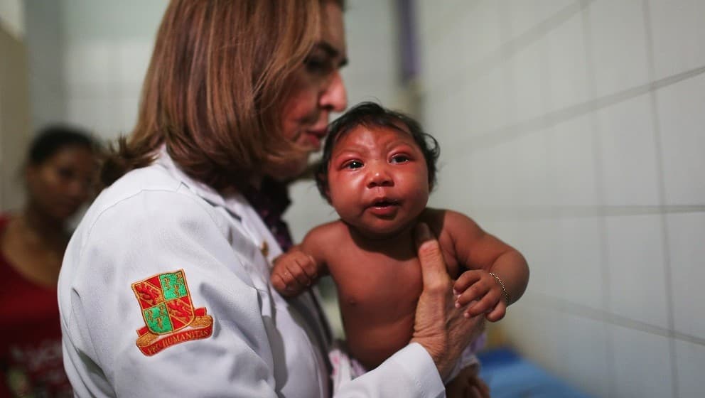 A zikafertőzés minden tizedik magzatnál születési rendellenességet okoz