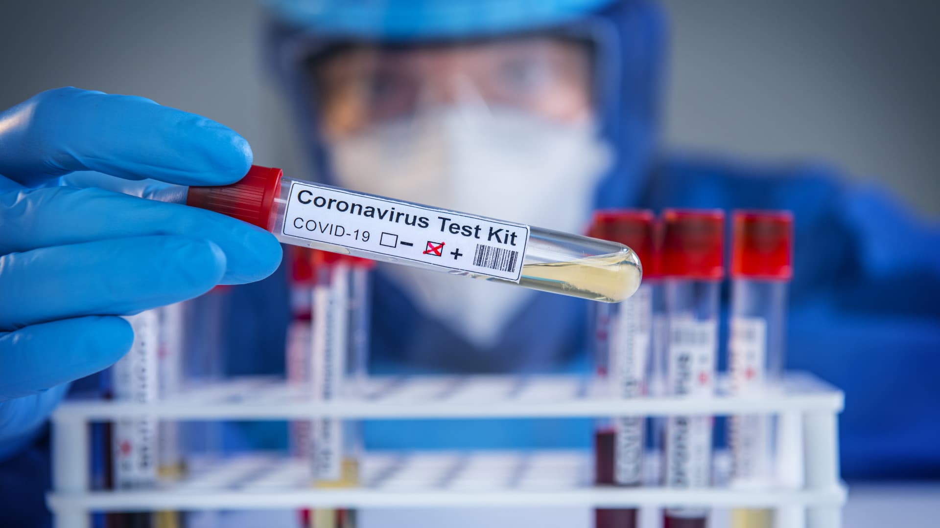 Koronavírus - 4 ezer felett az eddig azonosított koronavírusosok száma Szlovákiában
