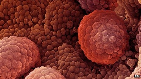 A rákkutatás új iránya nem a daganat elpusztítása, hanem a féken tartása lehet