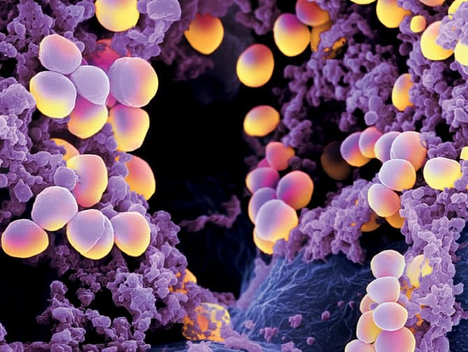 Az emberi orrban találtak rá a kutatók az új antibiotikumra