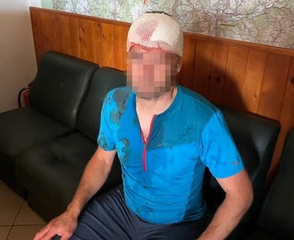 Hegyimentőre támadt egy medve a turistaösvényen, Kollár alaposan kiosztotta a környezetvédelmi minisztert