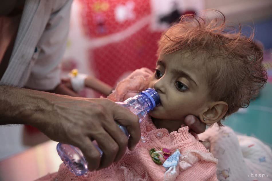 A jemeni polgárháborúban már több mint 11 ezer gyerek vált a harcok áldozatává