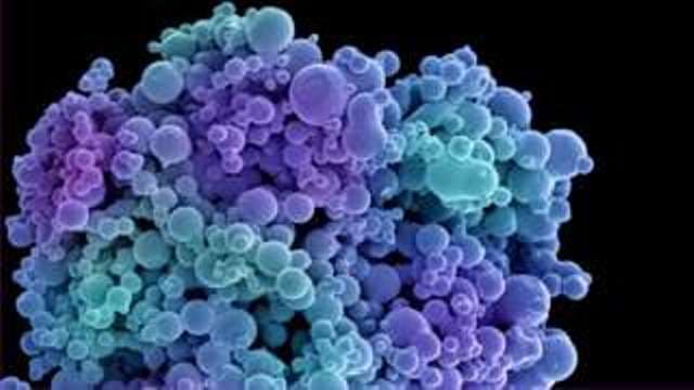 Hőre robbanó mikroszkopikus "gránátot" fejlesztenek a rák ellen