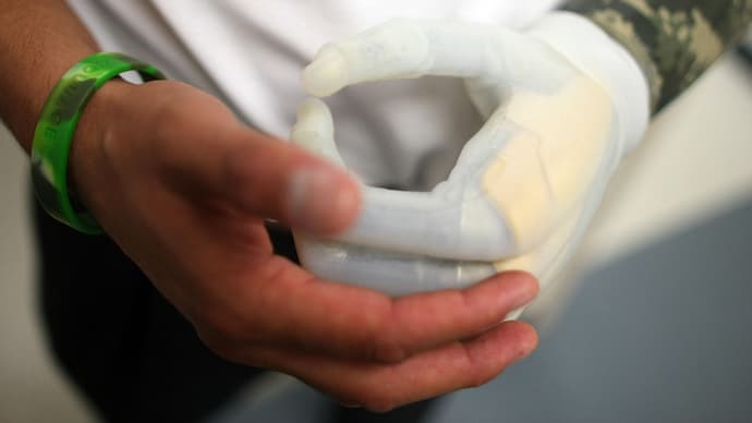 Sikerrel teszteltek tapintást érzékelő bionikus kezet