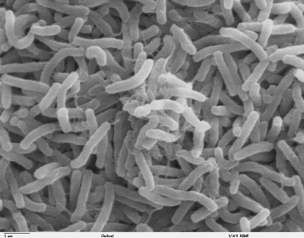 Százéves kolerabaktérium génjeit térképezték fel a kutatók
