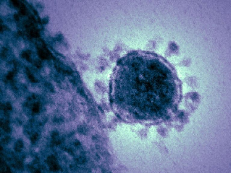 Harmincan hunytak el koronavírusban Olaszországban az elmúlt egy napban