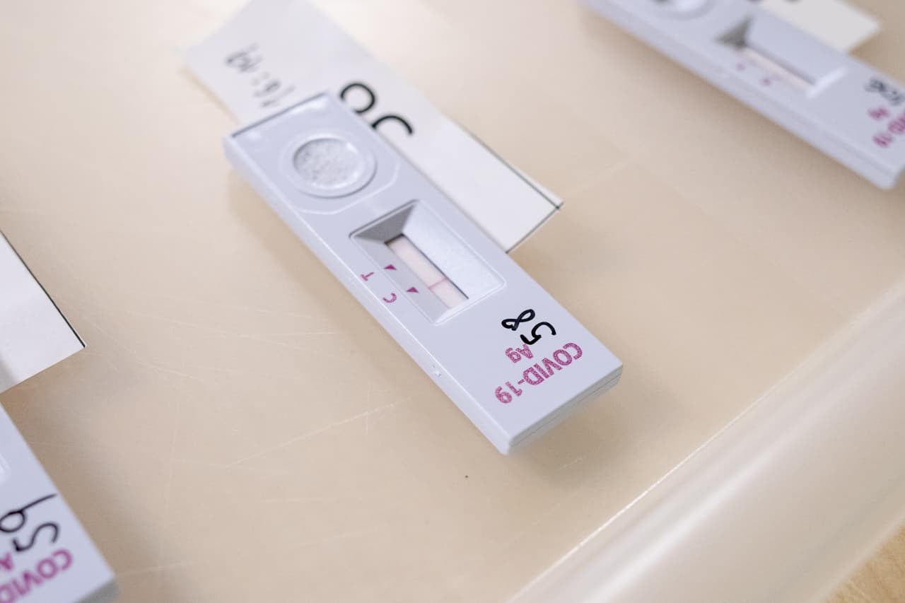 KORONAVÍRUS: A PCR- és az antigéntesztekkel együtt több mint 10 ezer fertőzöttet találtak egyetlen nap alatt Szlovákiában