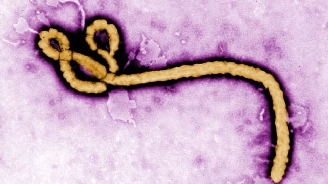 Ebola - A WHO a legrosszabb forgatókönyvre készül a Kongói DK-ban