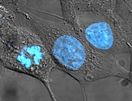 A sejtmagok periódusos rendszerét építik fel biológusok