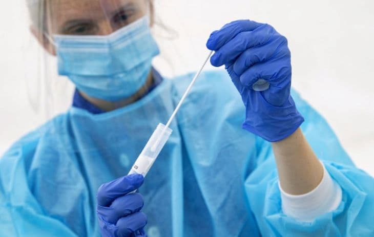 Egyre több az új koronavírus-fertőzött Szlovákiában, szerdán minden negyedik PCR-teszt pozitív lett