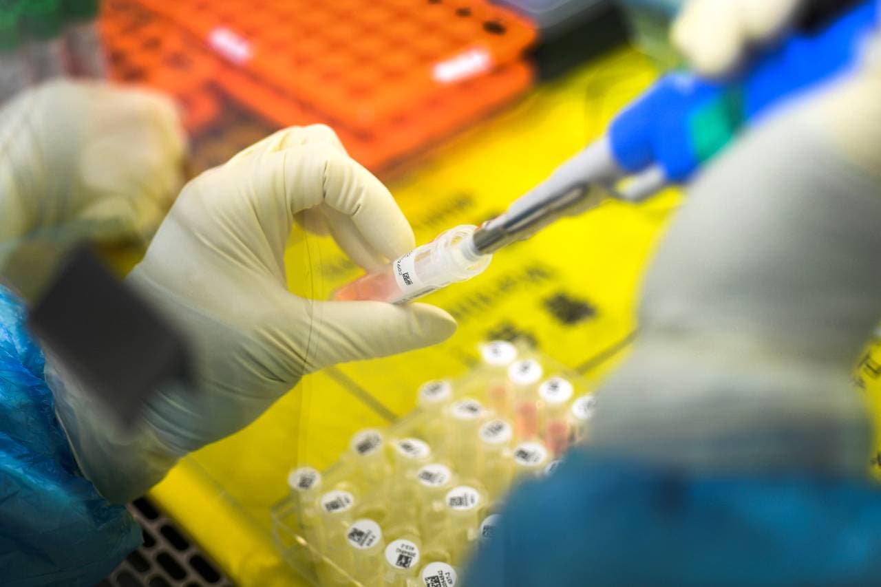 Már több mint kétszáz tesztet elvégeztek, egy sem igazolta a koronavírus jelenlétét Szlovákiában