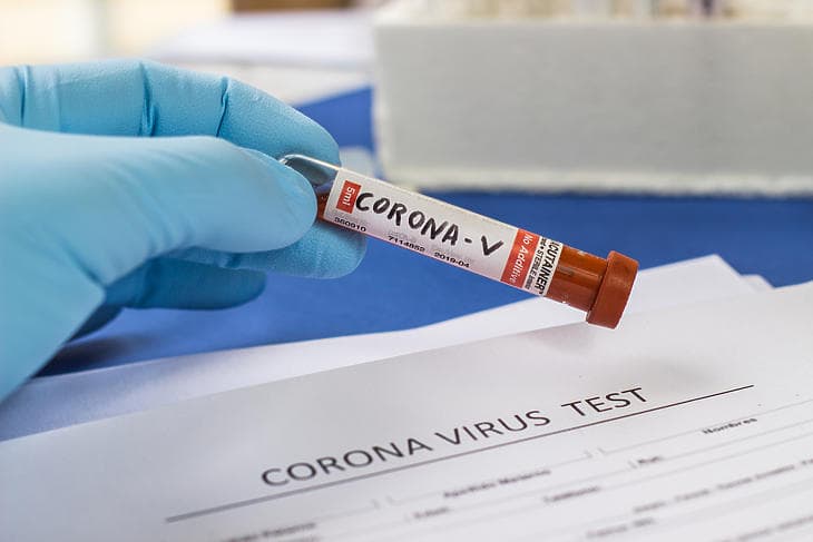 Koronavírus - Mintegy két-két tucat fertőzöttet regisztráltak vasárnap a Dunaszerdahelyi és a Galántai járásban