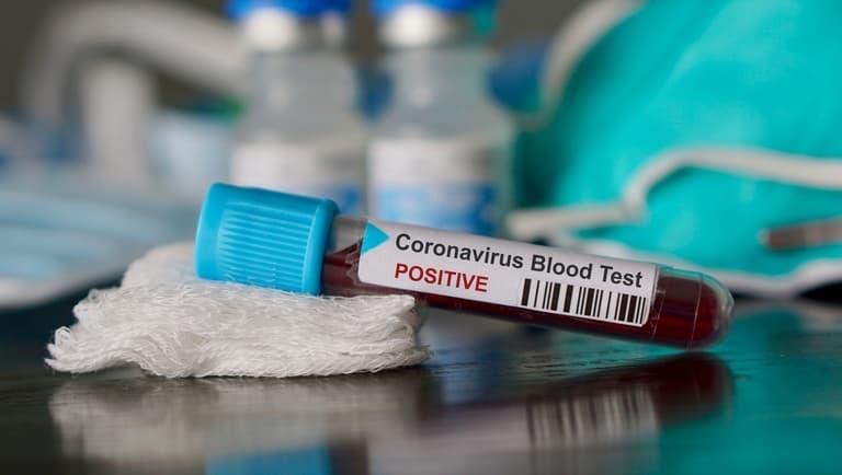 Koronavírus: Egy nap alatt 684-gyel emelkedett a brit halálos áldozatok száma