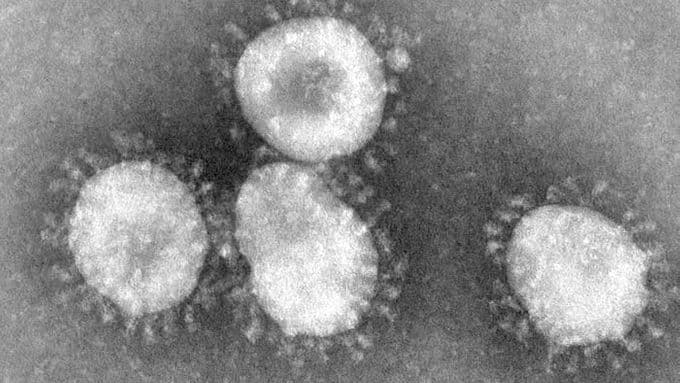 Koronavírus-fertőzés gyanújával szállítottak kórházba Budapesten 15 japán turistát!