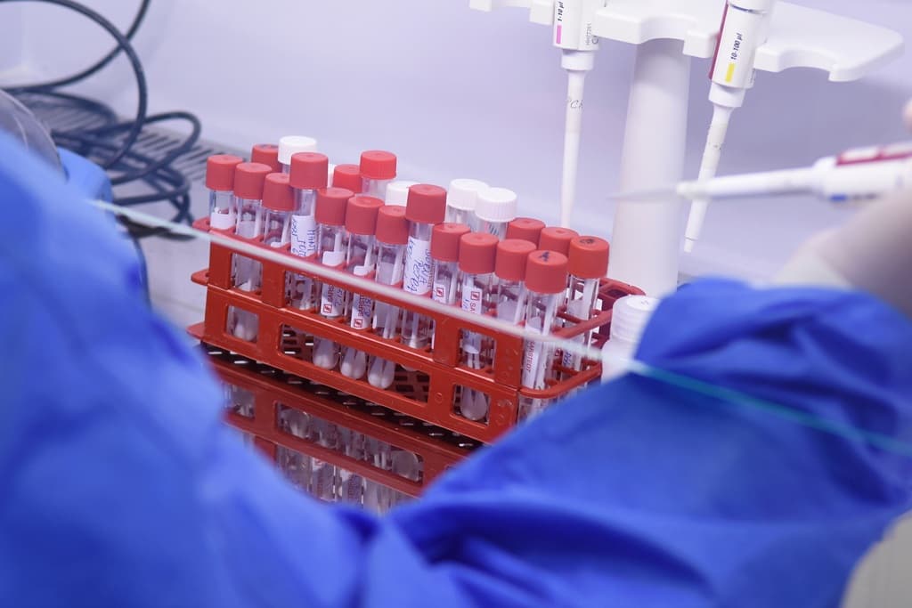Megfertőződött koronavírussal negyven tesztelő a Fülöp-szigetek legnagyobb laboratóriumában