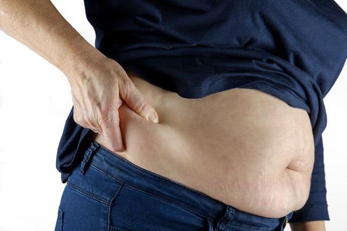 WHO: "Járványos méreteket" öltött az elhízás és a túlsúly Európában
