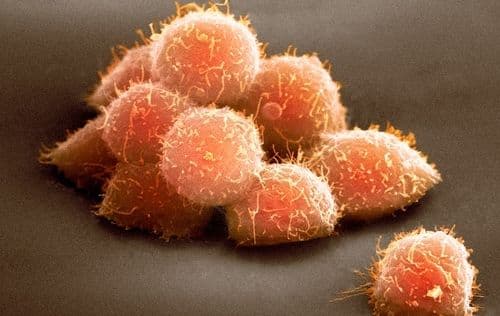 Embriószerű kísérleti modellt hoztak létre kutatók emberi őssejtekből